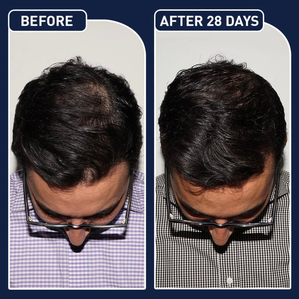 FEGPlus Minoxidil Beard & Hair Growth Serum