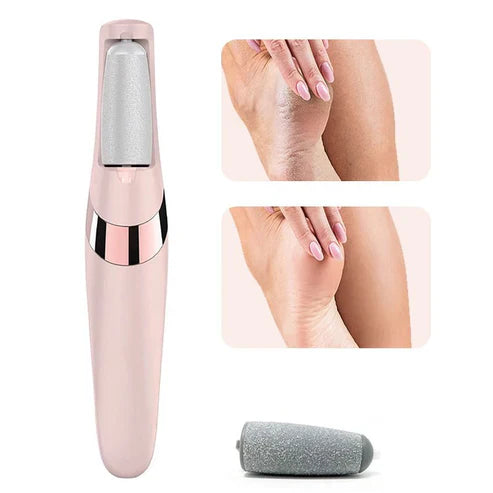 Electric Callus Remover
